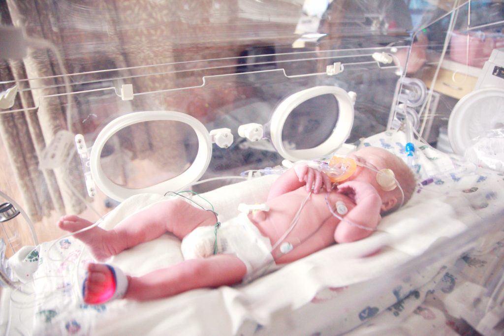 Quelles sont les démarches d'une naissance prématurée ?